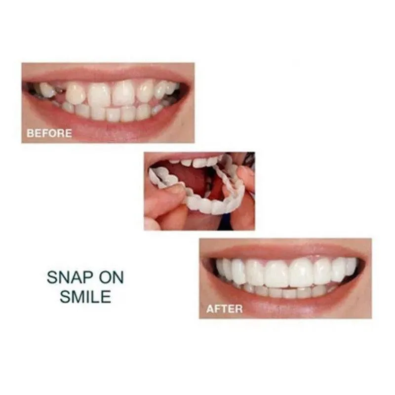 Whitening Braces Simulation Teeth Denture Brace